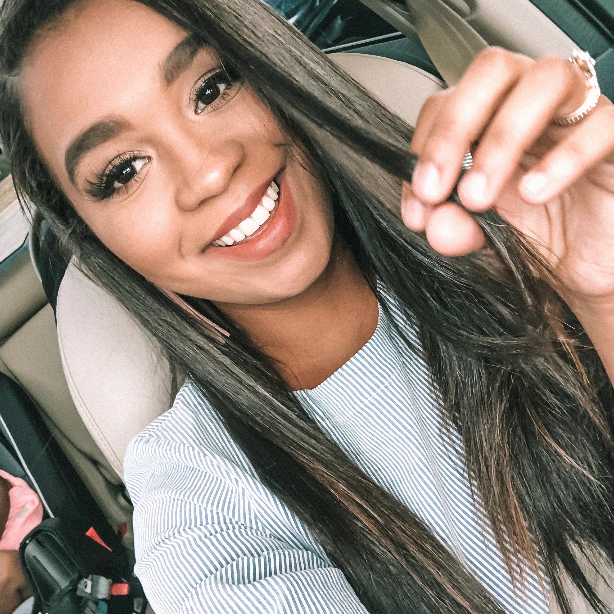 My New Smile | Recapping My Experience with Runion Dental Group
